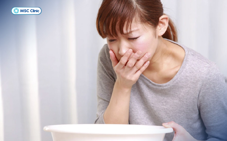 Các dấu hiệu viêm gan B cấp tính có thể gồm mệt mỏi, buồn nôn