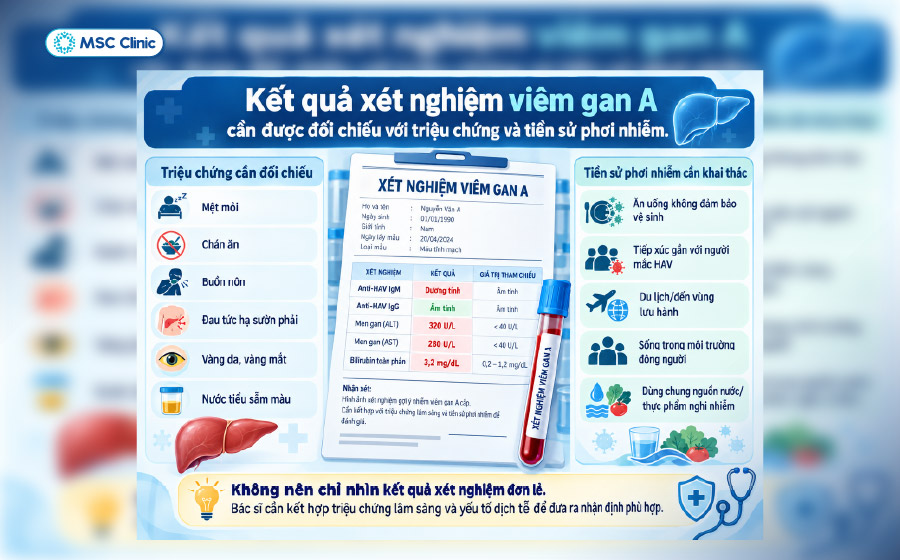 Kết quả xét nghiệm viêm gan A cần được đối chiếu với triệu chứng và tiền sử phơi nhiễm