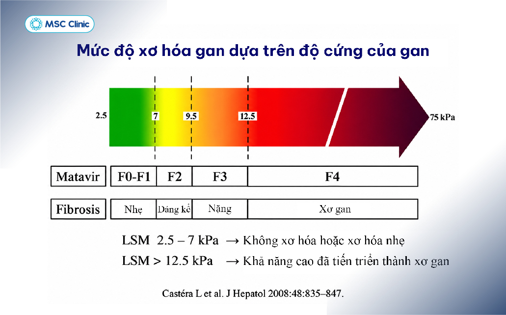 Đo độ đàn hồi gan giúp đánh giá độ cứng của gan, hỗ trợ xác định mức độ xơ hóa và định hướng điều trị phù hợp