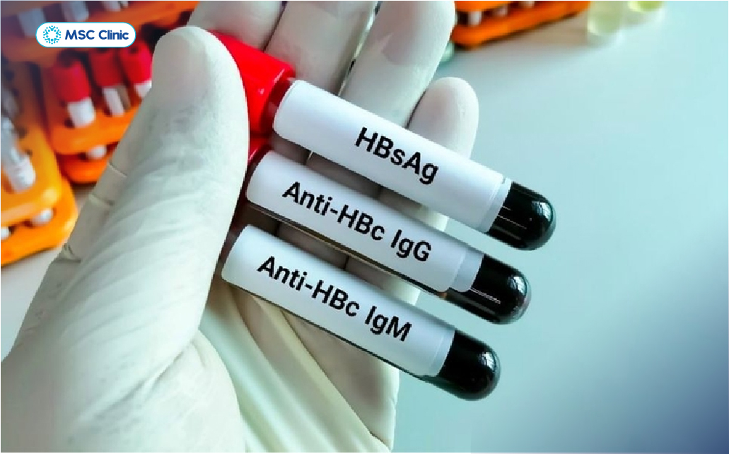Các xét nghiệm chuyên sâu cho biết chính xác mức độ hoạt động của virus HBV và tổn thương cấu trúc khác của lá gan