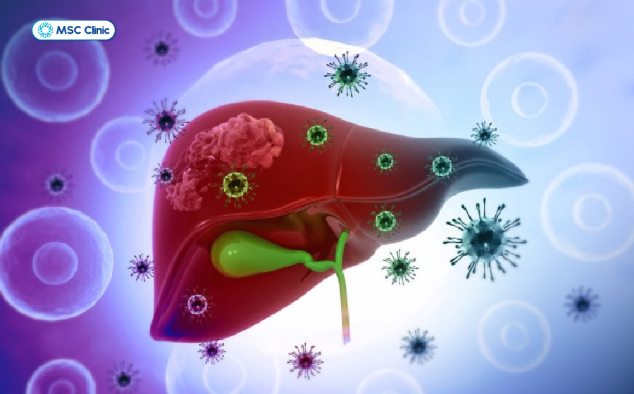 Hệ miễn dịch kìm hãm virus, khiến cho HBV chuyển sang trạng thái không hoạt động Hệ miễn dịch kìm hãm virus, khiến cho HBV chuyển sang trạng thái không hoạt động