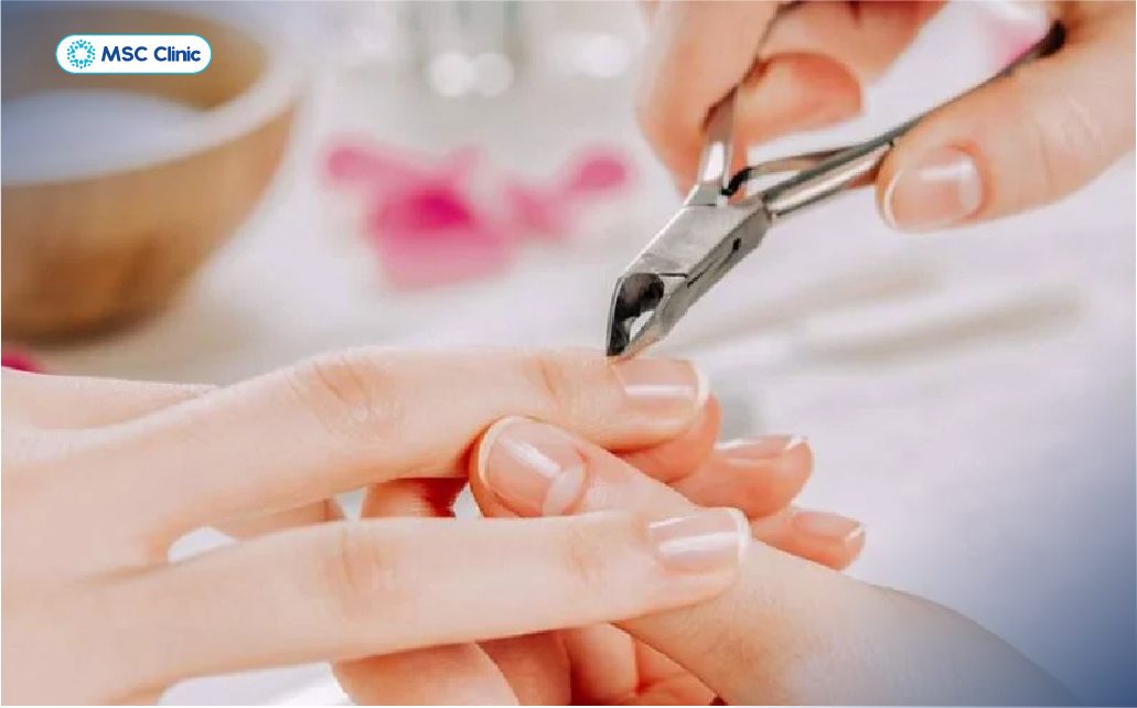 Không dùng chung các vật dụng cá nhân như bấm móng tay, dao cạo râu hay bàn chải để ngăn ngừa lây nhiễm HBV