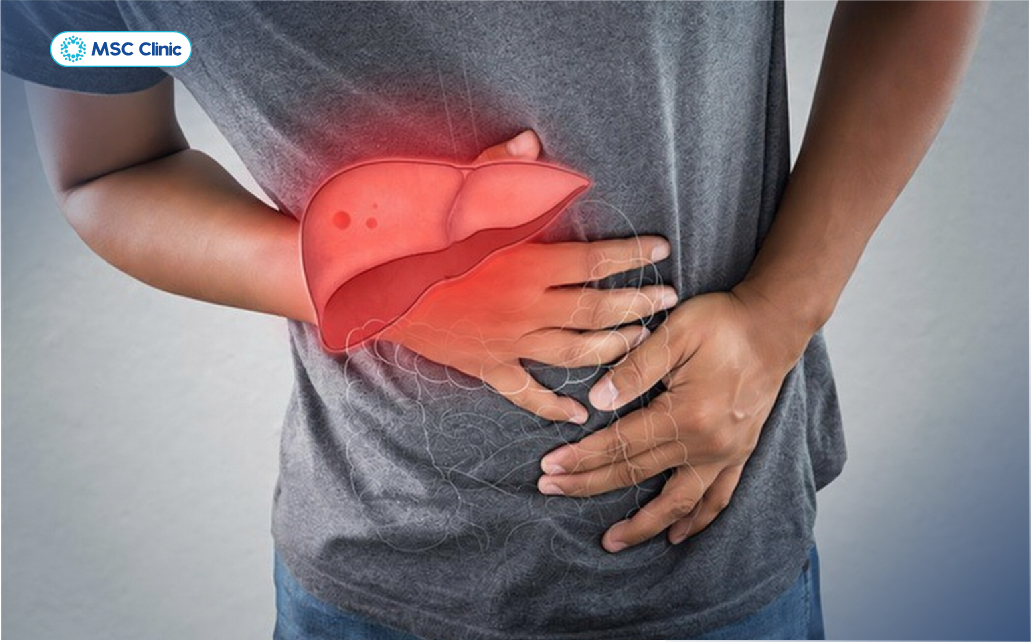 Men gan cao có thể diễn biến âm thầm, nhiều người chỉ phát hiện bất thường khi xét nghiệm máu