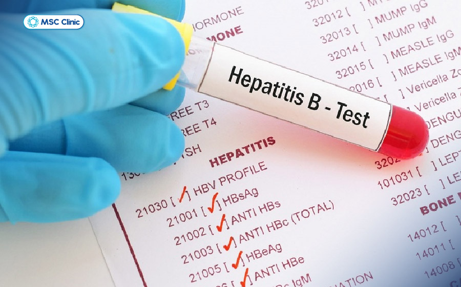 Người bệnh cần làm các xét nghiệm chuyên sâu để đánh giá virus HBV đang ở thể nào Người bệnh cần làm các xét nghiệm chuyên sâu để đánh giá virus HBV đang ở thể nào