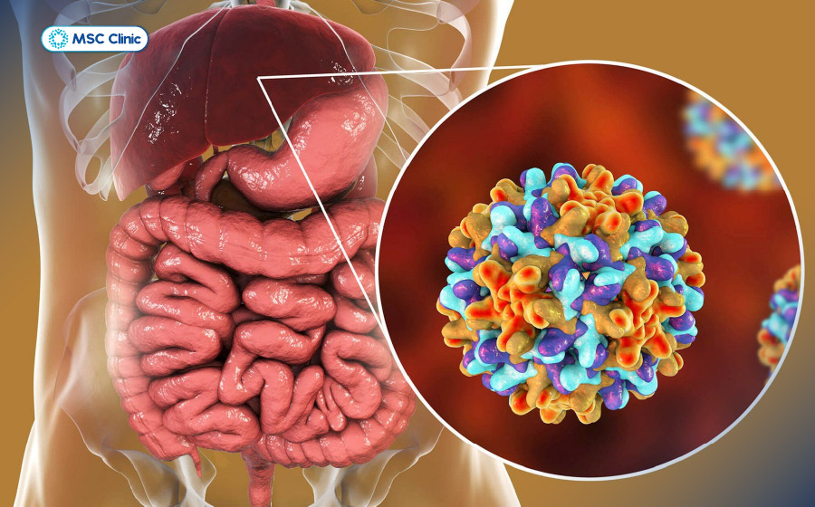 Virus viêm gan B có thể hoạt động trở lại nếu người bệnh suy giảm miễn dịch hoặc quay trở lại lối sống không lành mạnh Virus viêm gan B có thể hoạt động trở lại nếu người bệnh suy giảm miễn dịch hoặc quay trở lại lối sống không lành mạnh